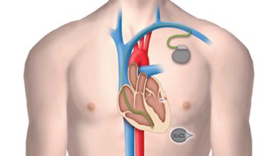 Pacemaker : attention à votre iPad !