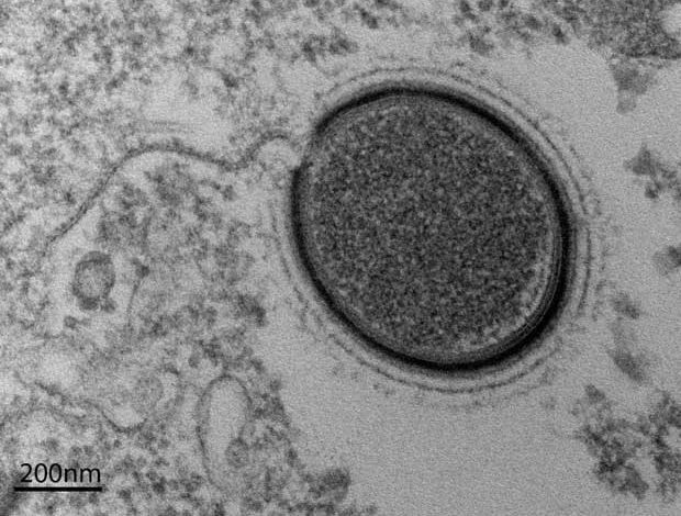 Le Mollivirus sibericum est un virus géant préhistorique qui dormait depuis 30 000 ans !